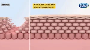 Stepping Out With Scholl