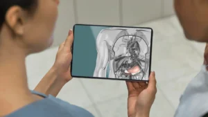 Creating a Mode of Action Animation